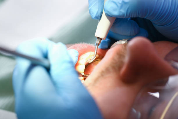 Best Orthodontic Emergency Dentist in Albany, MO
